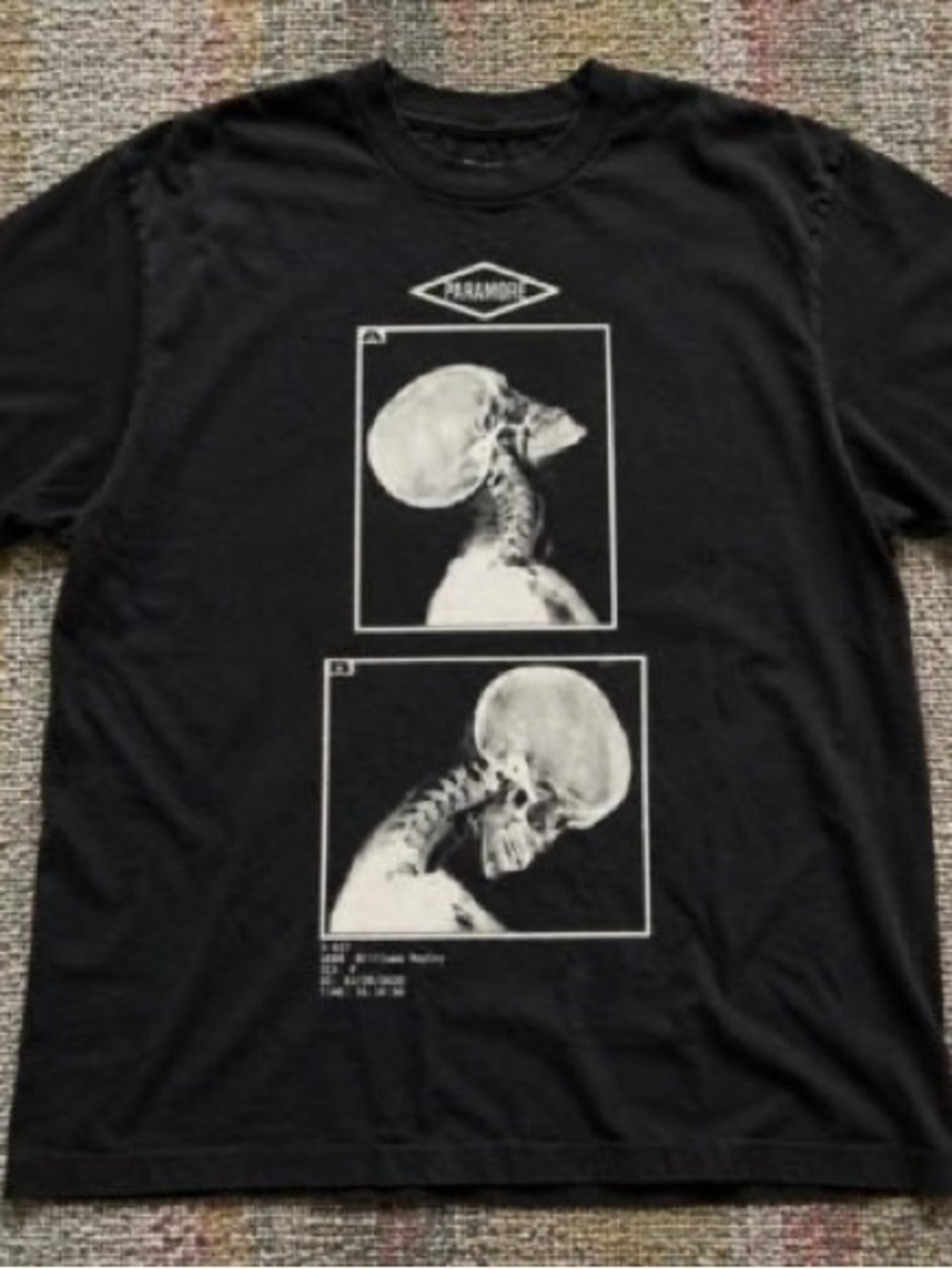 Black Paramore Graphic Skull X-Ray Tee - Men